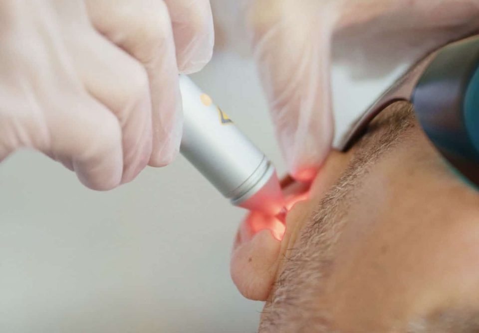 laser-ooracupunctuur laserOstop stoppen met roken rookstop laser-ooracupunctuur laserOstop stoppen met roken rookstop